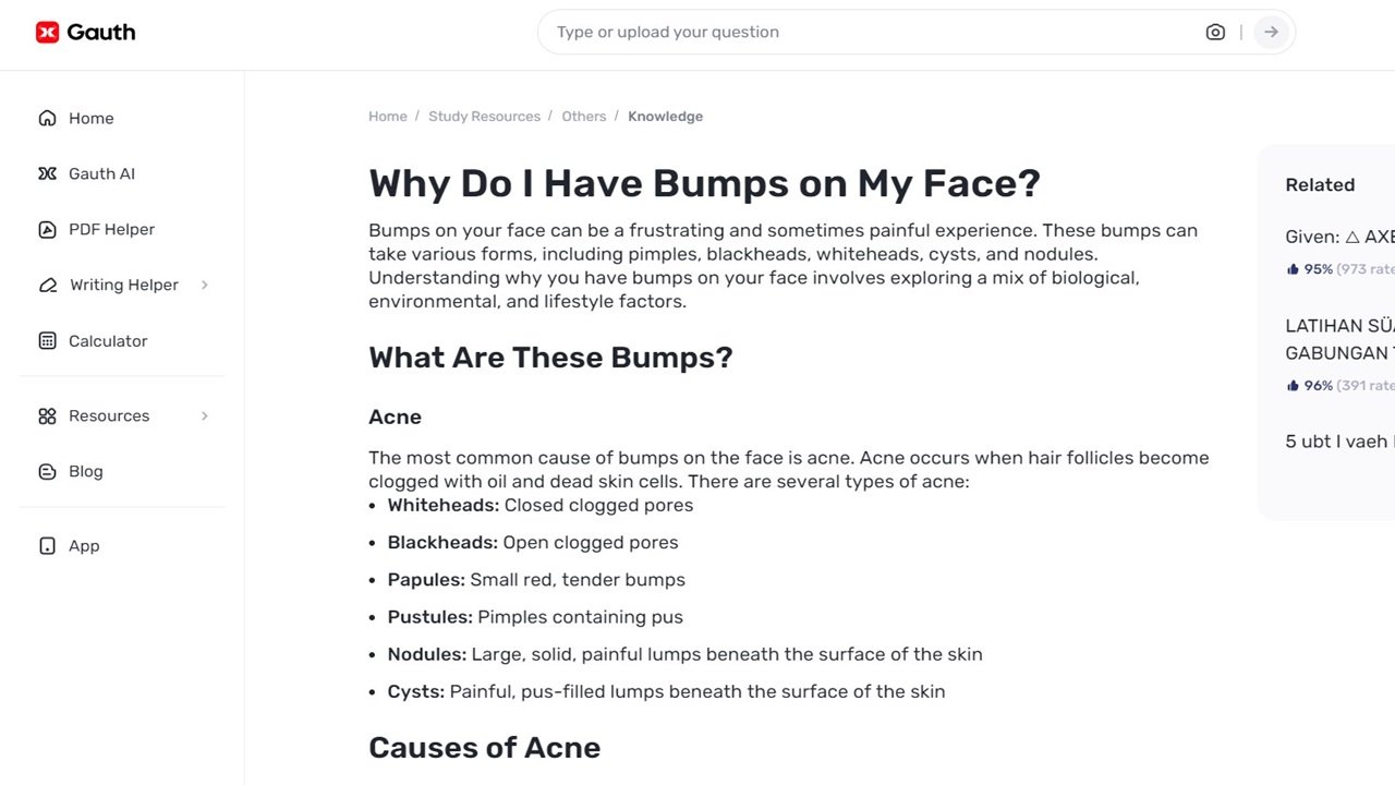 Using Gauth to Write on Facial Bumps